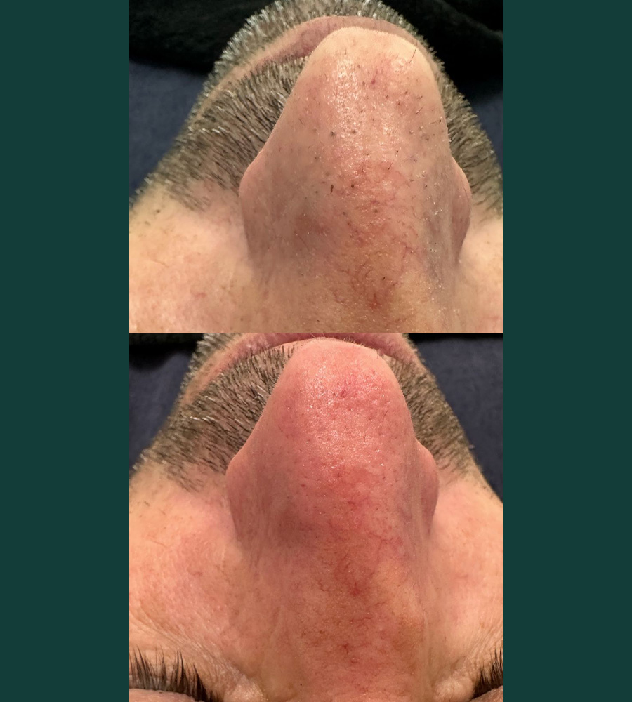 Advanced Skin IS